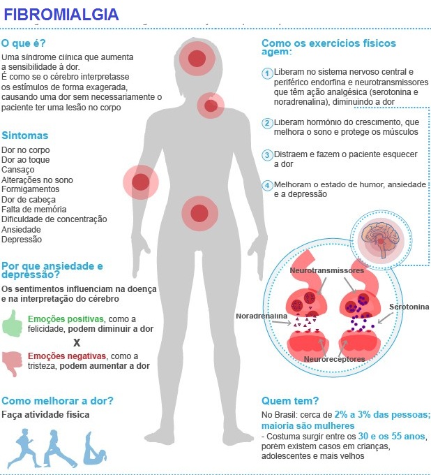 Sociedade Paranaense De Reumatologia O Que é Fibromialgia 1006