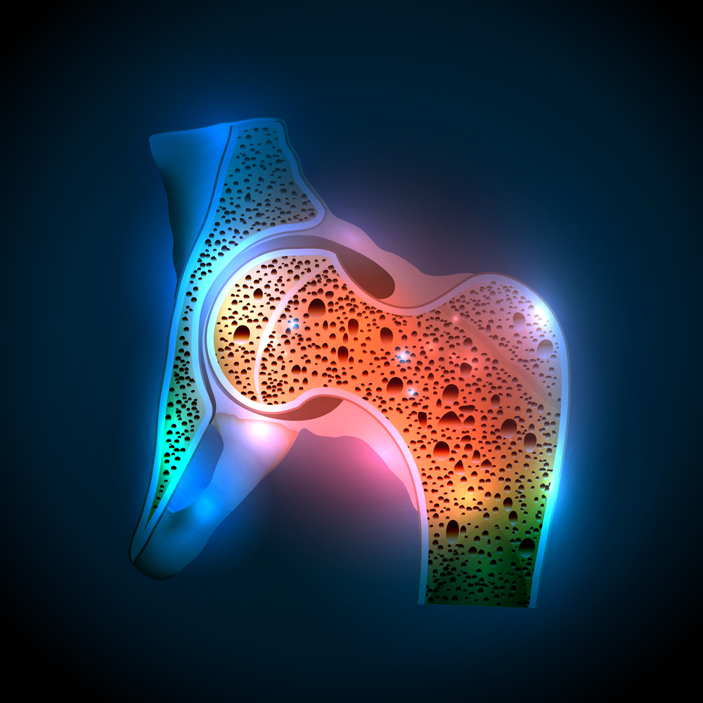 Read more about the article Osteoporose: mal silencioso ataca mulheres e homens