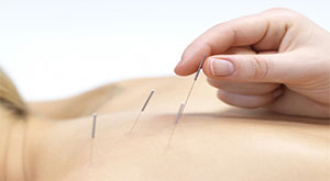 Read more about the article Reumatologista lembra que acupuntura ajuda no tratamento de doenças reumáticas