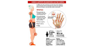 Read more about the article Artrite reumatoide afeta milhões de brasileiros