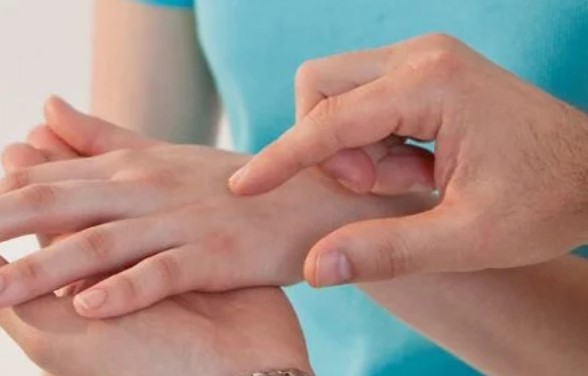esclerodermia